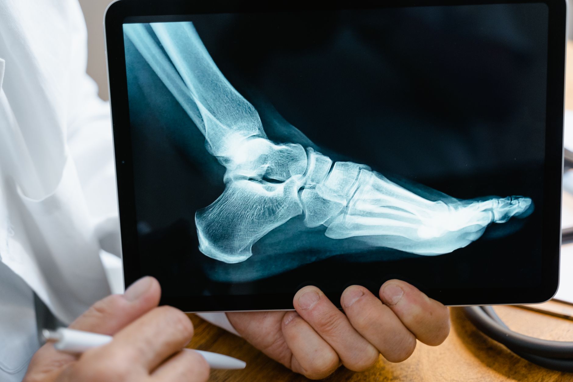 Can Foot Dragging Be an Early Sign of Parkinson’s?