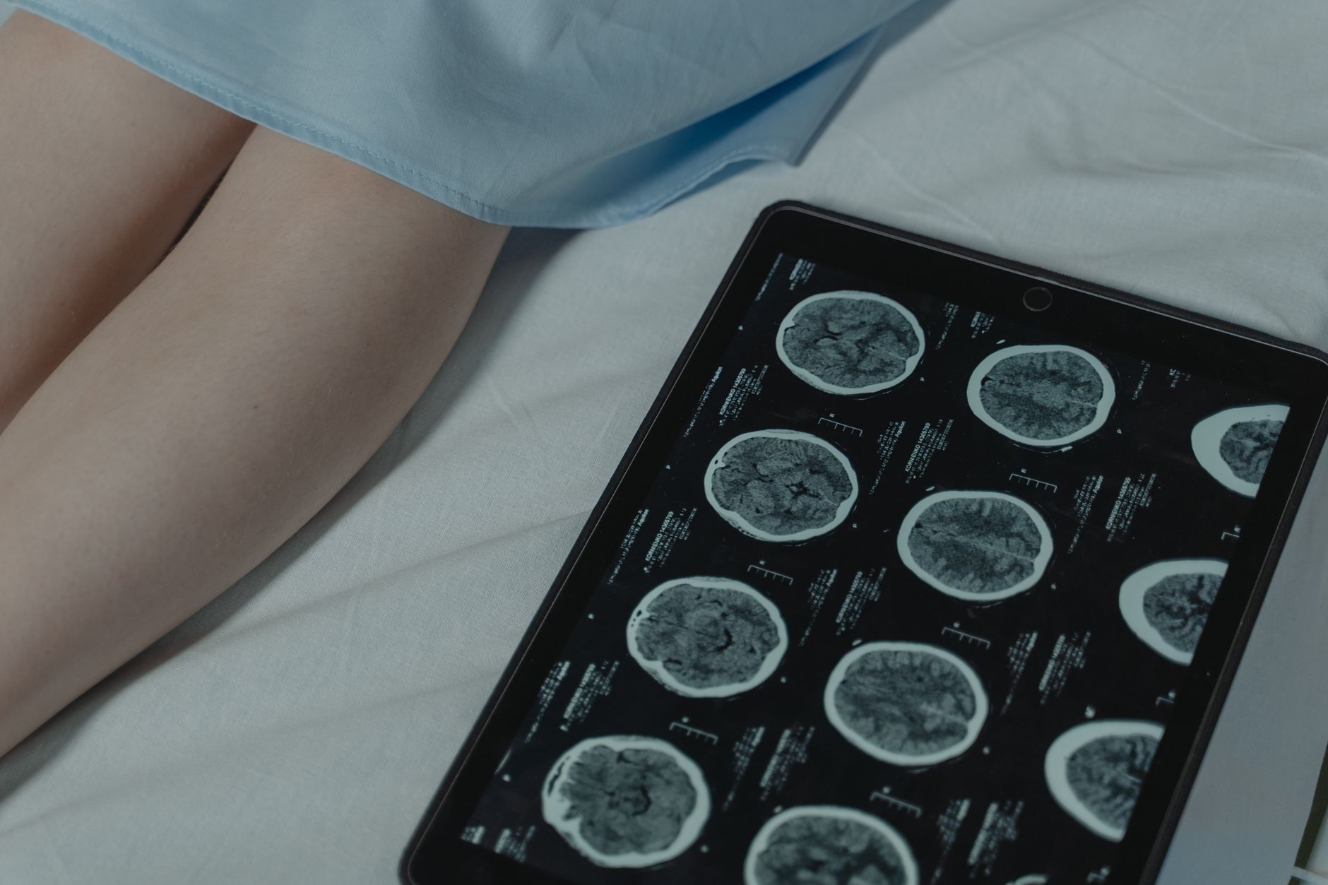 Tablet Games Could Help Assess Memory and Thinking Problems in Parkinson's - Featured image