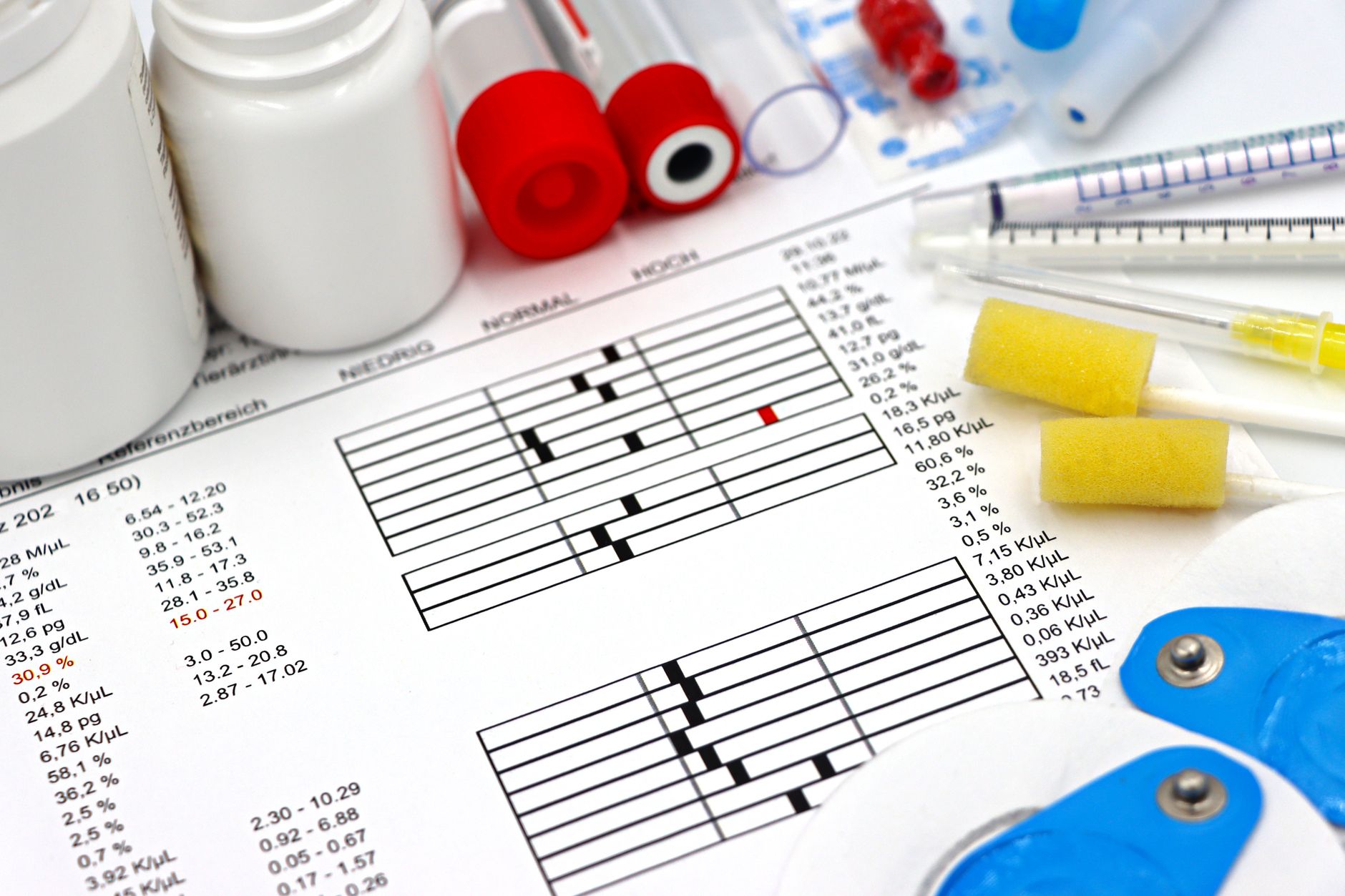 Tear Biomarker Test Could Replace Blood Work for Parkinson's Screening - Featured image