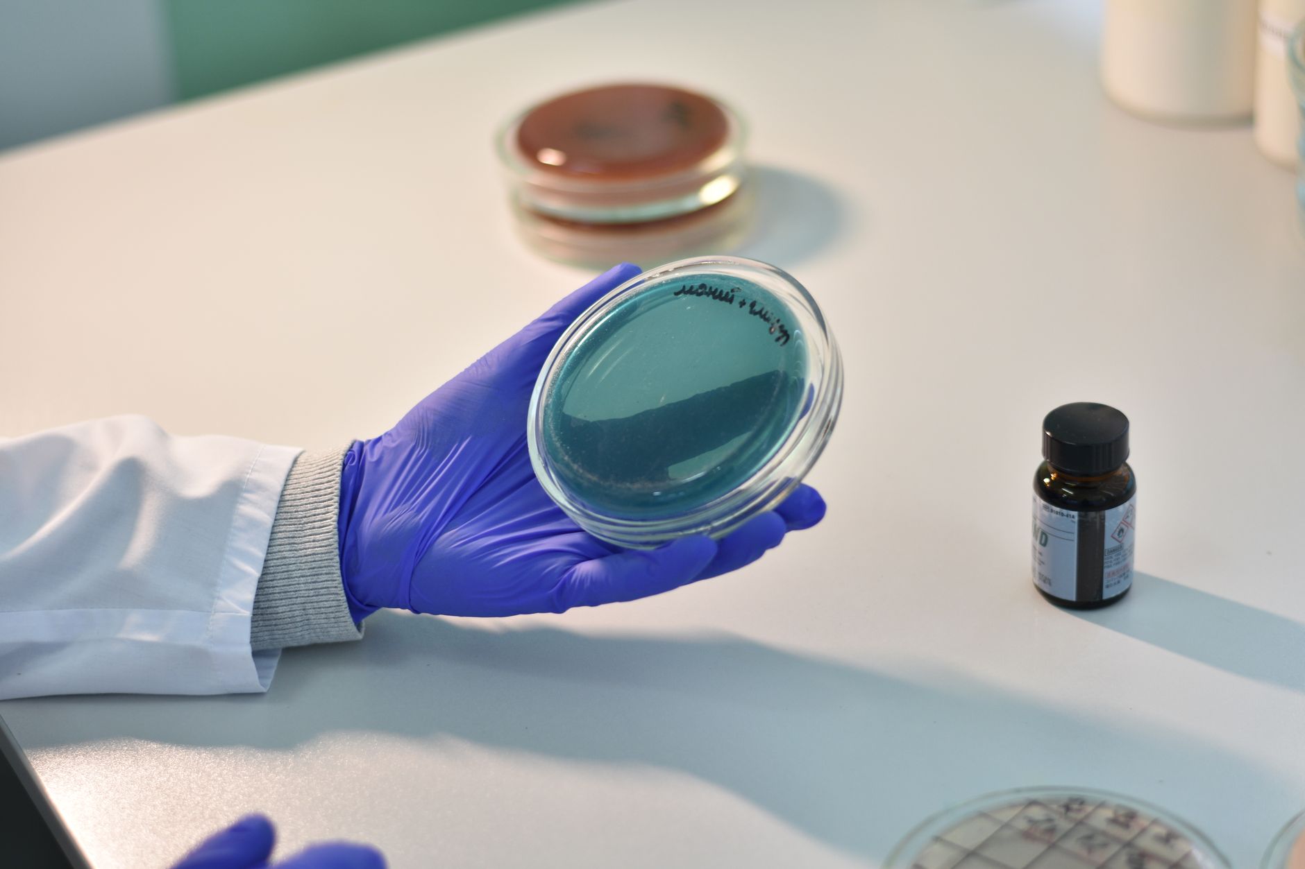 Why Parkinson's Can Affect Body Temperature - Featured image