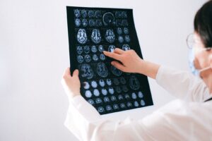 Doctor pointing at a brain MRI scan