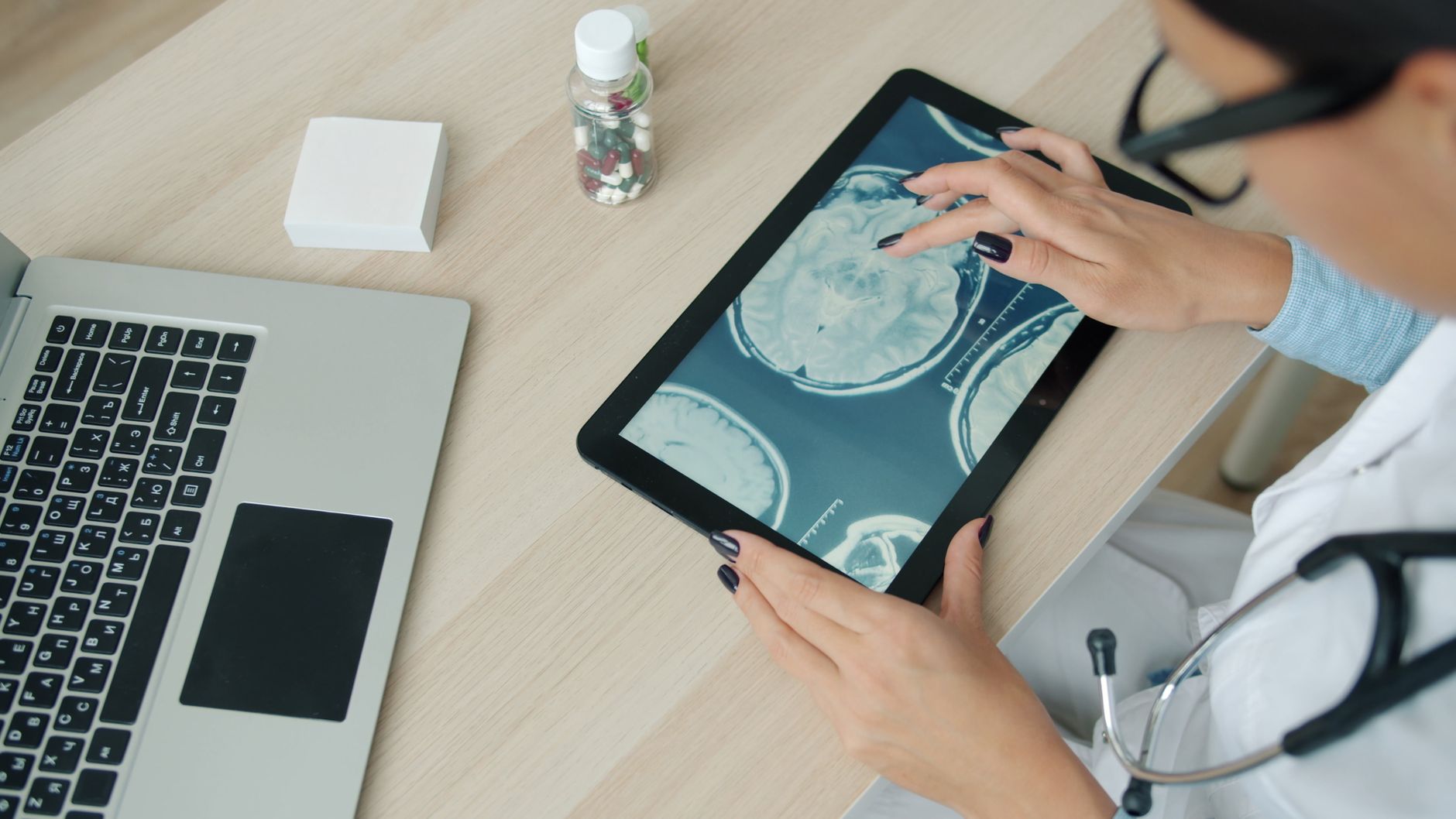 Deep Brain Stimulation: What Caregivers Should Know Before Surgery Day - Featured image